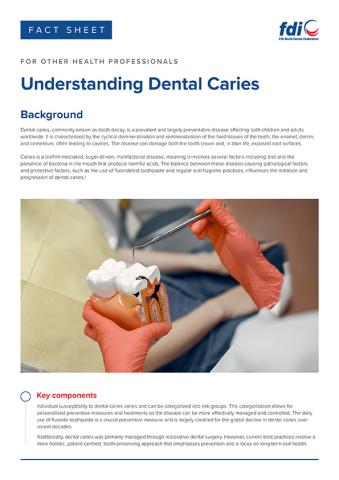 Fact sheet - Understanding Dental Caries